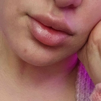 Blixi Nude
